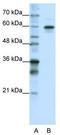 Heterogeneous Nuclear Ribonucleoprotein L Like antibody, TA343980, Origene, Western Blot image 