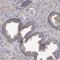 Acid Sensing Ion Channel Subunit Family Member 5 antibody, NBP1-86356, Novus Biologicals, Immunohistochemistry paraffin image 