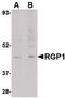 Retrograde Golgi transport protein RGP1 homolog antibody, PA5-20519, Invitrogen Antibodies, Western Blot image 