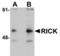 Receptor-interacting serine/threonine-protein kinase 2 antibody, TA306013, Origene, Western Blot image 