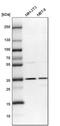 DnaJ Heat Shock Protein Family (Hsp40) Member C17 antibody, PA5-59349, Invitrogen Antibodies, Western Blot image 