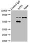 Lymphocyte Cytosolic Protein 1 antibody, LS-C369901, Lifespan Biosciences, Immunoprecipitation image 
