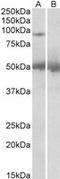 Ubiquitin Specific Peptidase 6 antibody, MBS420763, MyBioSource, Western Blot image 