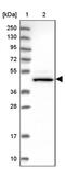 Carbohydrate Sulfotransferase 12 antibody, PA5-59672, Invitrogen Antibodies, Western Blot image 