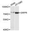 SRP Receptor Subunit Alpha antibody, A12340, Boster Biological Technology, Western Blot image 