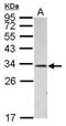 RP3 antibody, PA5-30453, Invitrogen Antibodies, Western Blot image 
