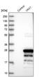 Ventral Anterior Homeobox 1 antibody, PA5-56017, Invitrogen Antibodies, Western Blot image 