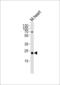 FBP antibody, 61-763, ProSci, Western Blot image 