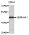Serpin Family F Member 1 antibody, MBS126753, MyBioSource, Western Blot image 