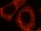 Ribosomal Protein L28 antibody, 16649-1-AP, Proteintech Group, Immunofluorescence image 
