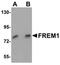 FRAS1 Related Extracellular Matrix 1 antibody, orb75452, Biorbyt, Western Blot image 