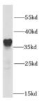 Survival Of Motor Neuron 2, Centromeric antibody, FNab08032, FineTest, Western Blot image 