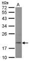 5', 3'-Nucleotidase, Cytosolic antibody, GTX122905, GeneTex, Western Blot image 