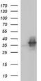 NF-kappa-B inhibitor alpha antibody, CF507172, Origene, Western Blot image 