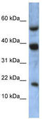 Ataxin 7 Like 1 antibody, TA329783, Origene, Western Blot image 