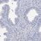 Protein Phosphatase 1 Regulatory Subunit 32 antibody, HPA039068, Atlas Antibodies, Immunohistochemistry frozen image 