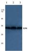 E2F Transcription Factor 6 antibody, AP06092PU-N, Origene, Western Blot image 