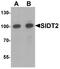 SID1 transmembrane family member 2 antibody, A09551, Boster Biological Technology, Western Blot image 
