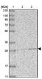 Abhydrolase Domain Containing 10 antibody, NBP1-83748, Novus Biologicals, Western Blot image 