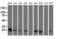 Superoxide Dismutase 2 antibody, LS-C172413, Lifespan Biosciences, Western Blot image 