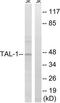 TAL BHLH Transcription Factor 1, Erythroid Differentiation Factor antibody, TA313028, Origene, Western Blot image 
