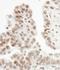 Zinc fingers and homeoboxes protein 1 antibody, H00011244-M01, Novus Biologicals, Enzyme Linked Immunosorbent Assay image 