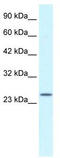 Zinc Finger AN1-Type Containing 6 antibody, TA335508, Origene, Western Blot image 