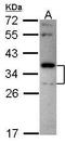 STOM antibody, GTX114389, GeneTex, Western Blot image 