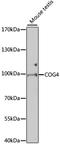 Component Of Oligomeric Golgi Complex 4 antibody, STJ110102, St John