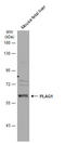 Zinc finger protein PLAG1 antibody, GTX124217, GeneTex, Western Blot image 