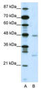MAX Dimerization Protein 4 antibody, TA331160, Origene, Western Blot image 