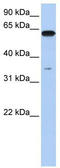 Karyopherin Subunit Alpha 6 antibody, TA334448, Origene, Western Blot image 