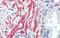 SSX Family Member 4B antibody, ARP35783_P050, Aviva Systems Biology, Immunohistochemistry frozen image 