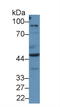 Preferentially Expressed Antigen In Melanoma antibody, LS-C296014, Lifespan Biosciences, Western Blot image 