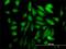SH3 Domain Containing 19 antibody, H00152503-M01, Novus Biologicals, Immunofluorescence image 