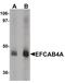 Calcium Release Activated Channel Regulator 2B antibody, PA5-21059, Invitrogen Antibodies, Western Blot image 