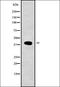 3-ketoacyl-CoA thiolase, mitochondrial antibody, orb337858, Biorbyt, Western Blot image 