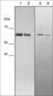 Secreted Phosphoprotein 1 antibody, OM5741, ECM Biosciences, Western Blot image 