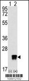 ADP Ribosylation Factor Like GTPase 3 antibody, 61-365, ProSci, Western Blot image 