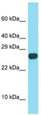 Sperm acrosome membrane-associated protein 3 antibody, TA331299, Origene, Western Blot image 