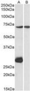 CPT2 antibody, NBP1-51993, Novus Biologicals, Western Blot image 