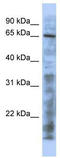 Histone acetyltransferase KAT5 antibody, TA330569, Origene, Western Blot image 