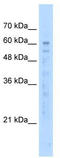EF-Hand Calcium Binding Domain 14 antibody, TA341958, Origene, Western Blot image 