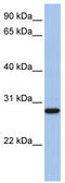 Voltage Dependent Anion Channel 3 antibody, TA338558, Origene, Western Blot image 