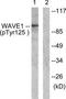 WASP Family Member 1 antibody, TA314837, Origene, Western Blot image 