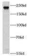 Exophilin 5 antibody, FNab02909, FineTest, Western Blot image 