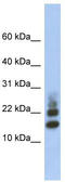 Ribosomal Protein S15a antibody, TA336044, Origene, Western Blot image 