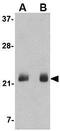 Fibroblast Growth Factor 4 antibody, GTX85040, GeneTex, Western Blot image 