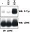 Lck-interacting transmembrane adapter 1 antibody, GTX78371, GeneTex, Immunoprecipitation image 