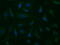 10-formyltetrahydrofolate dehydrogenase antibody, GTX84895, GeneTex, Immunofluorescence image 
